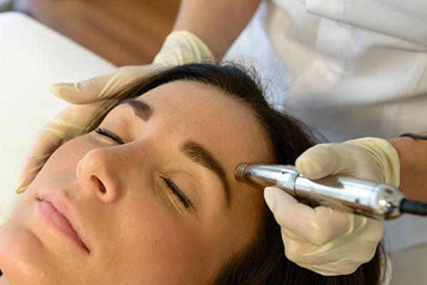 Microneedling Schermbeck