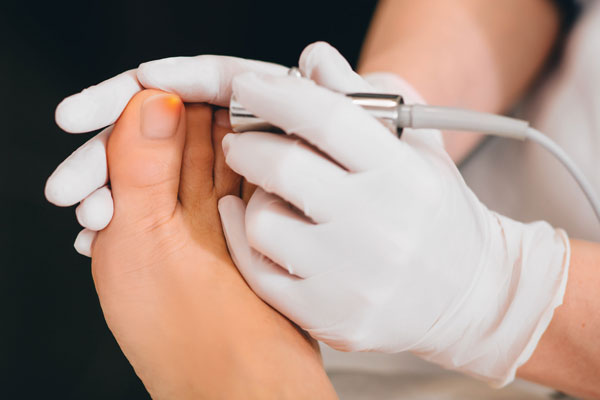 Nagelpilz­entfernung Schermbeck