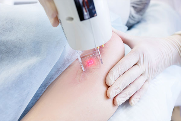 Narbenbehandlung Schermbeck